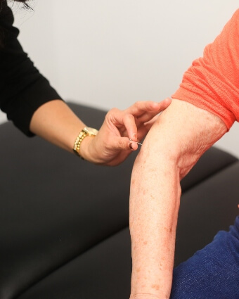 Acupuncture therapy close-up