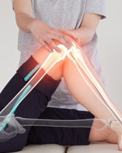 Bent knees with bones showing