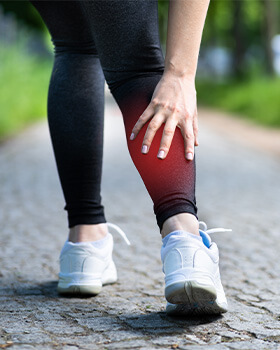 woman with calf pain