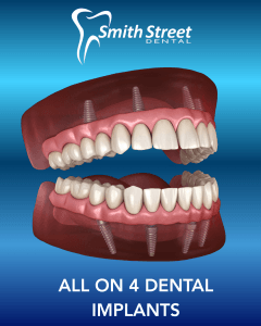 all on 4 Implants Penrith