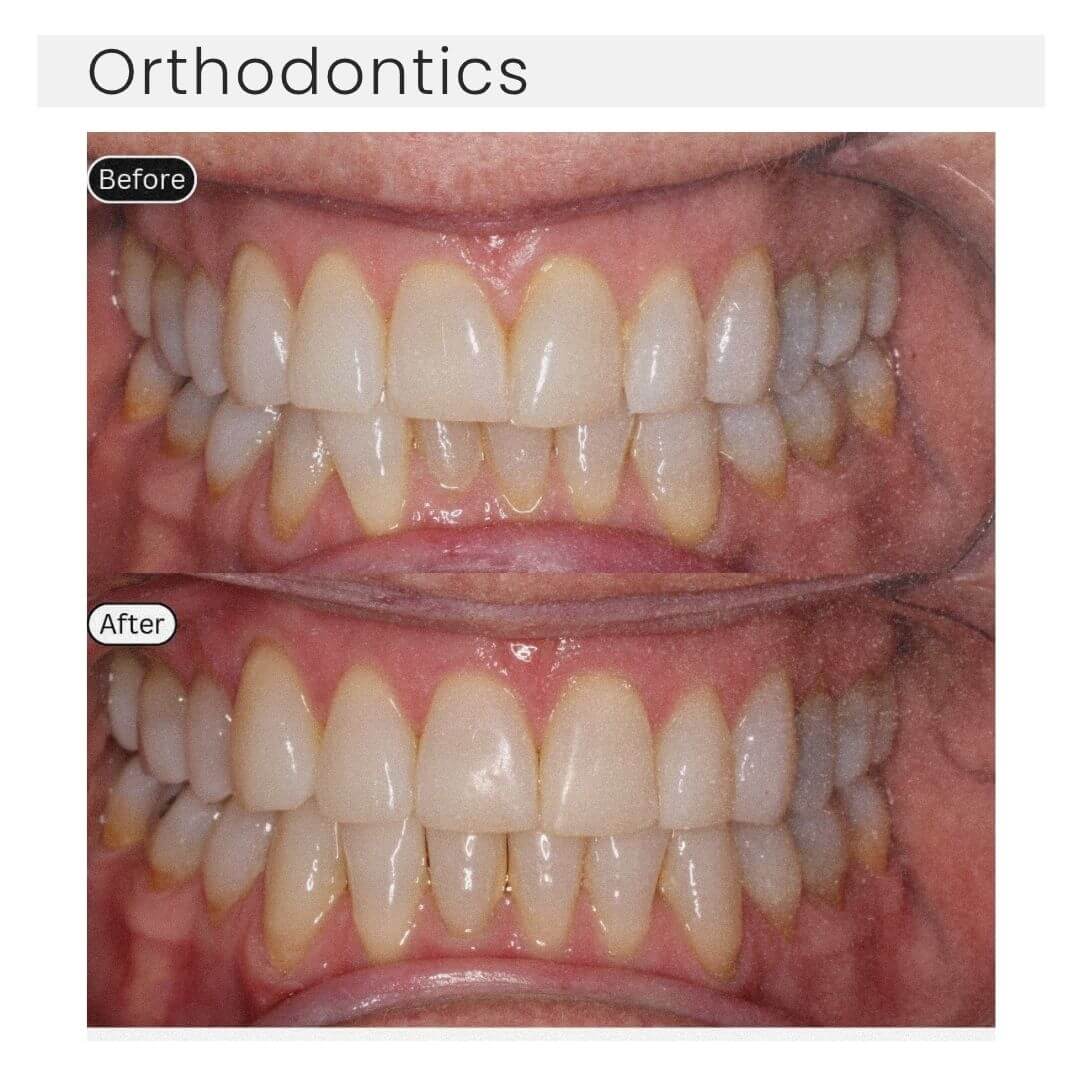 orthdontics