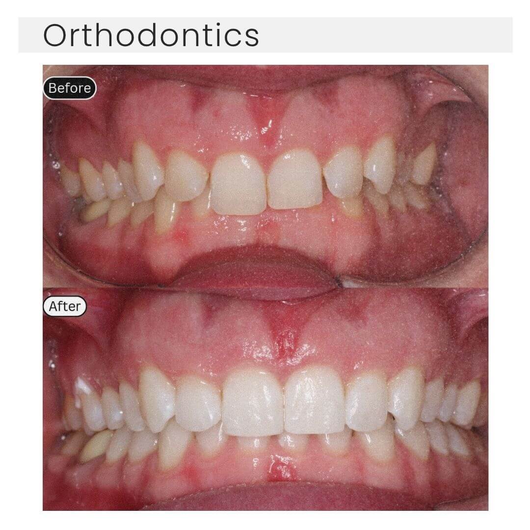 orthdontics
