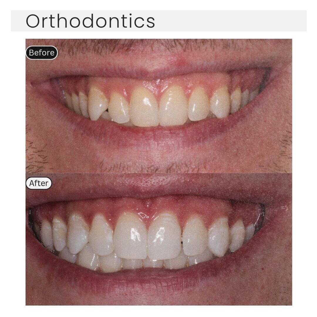 orthdontics