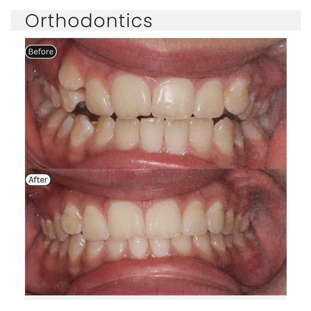orthdontics