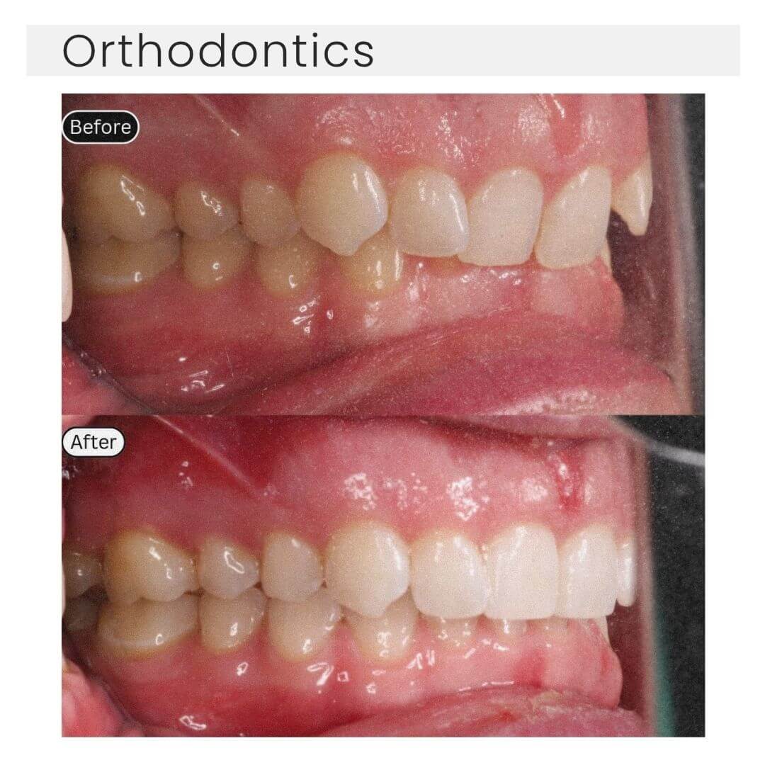 orthdontics