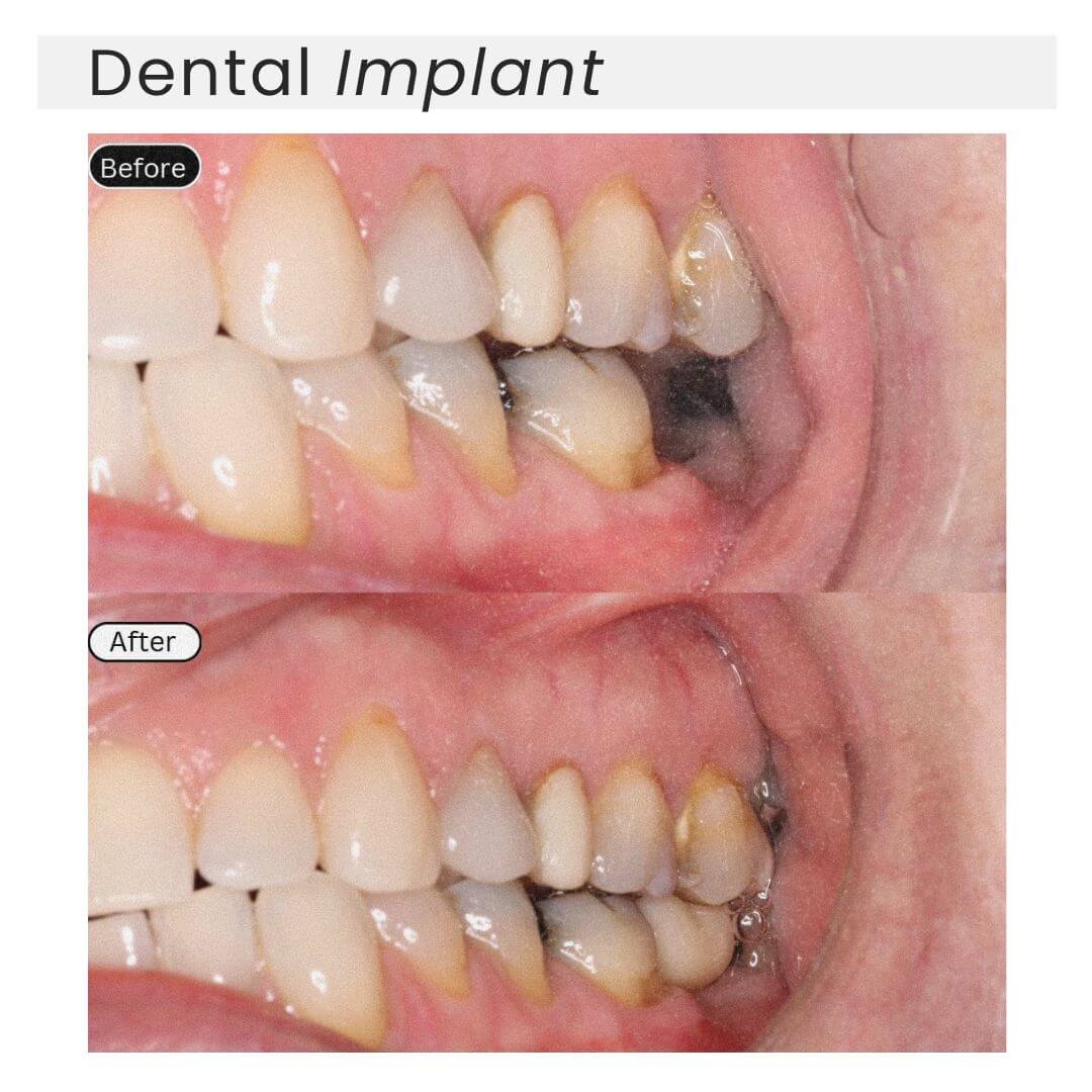 before and after