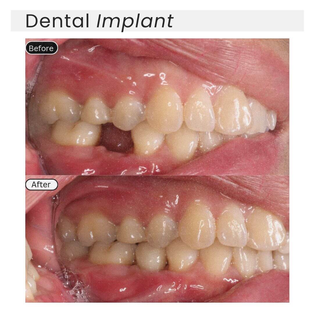 before and after