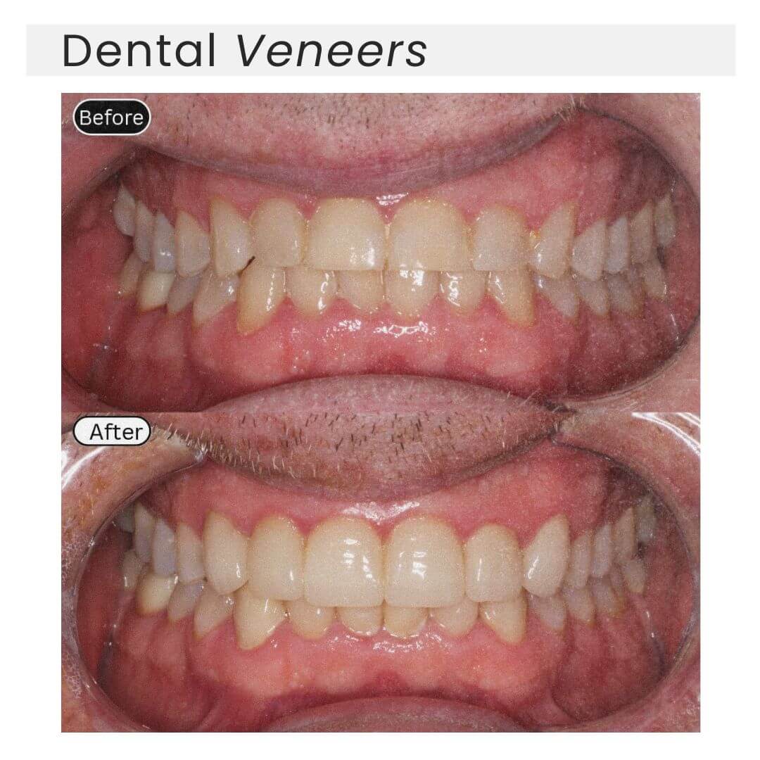 before and after