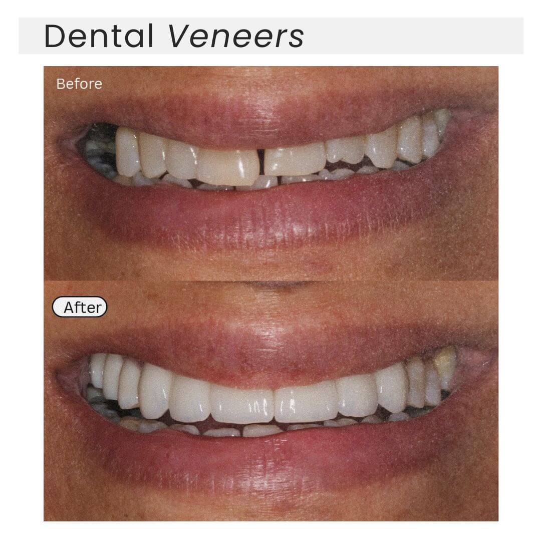 before and after