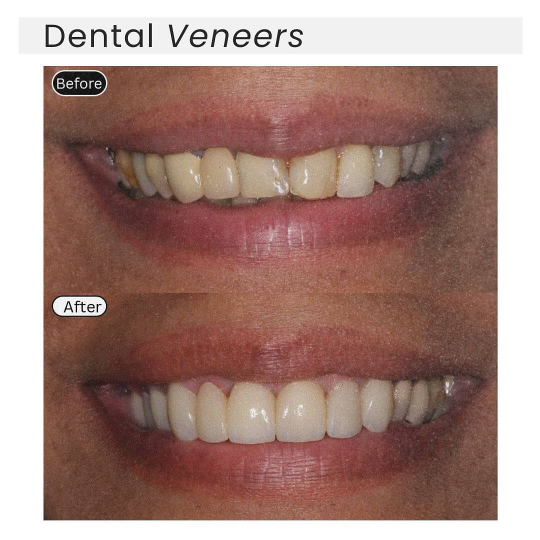 before and after