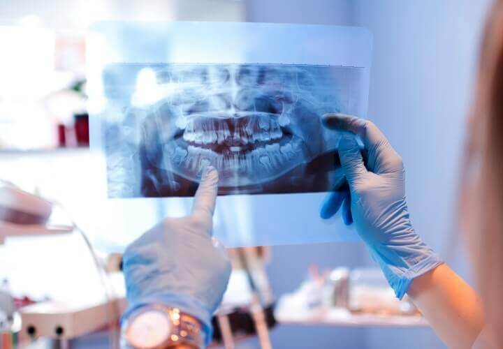 Dental X-ray