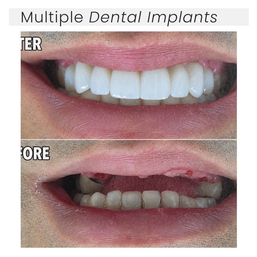 before and after