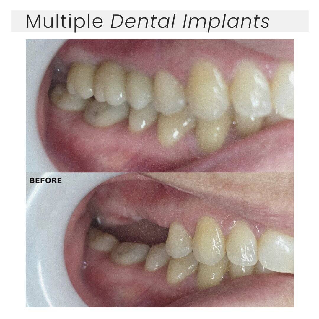 before and after