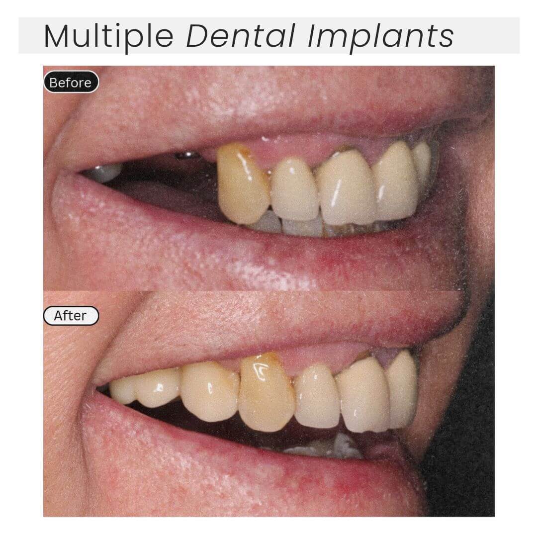 before and after