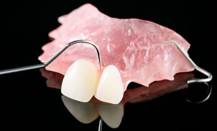 Partial Dentures