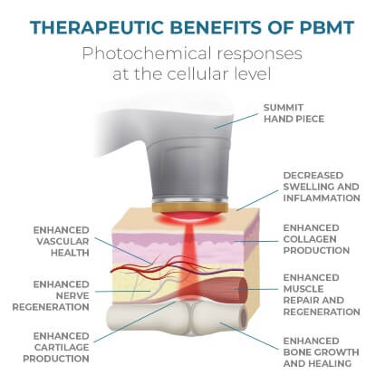 Essentials for Wellness Family Chiropractic Laser Therapy diagram