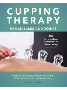 Cupping therapy