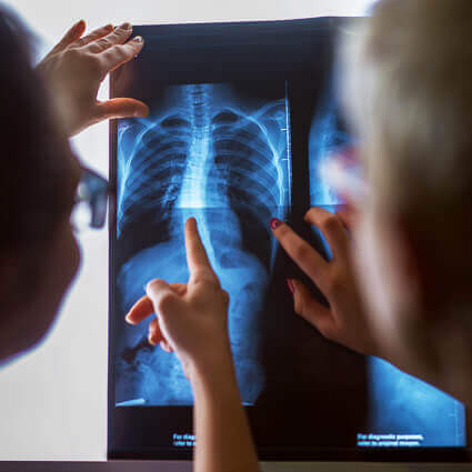 two people pointing at spinal xray