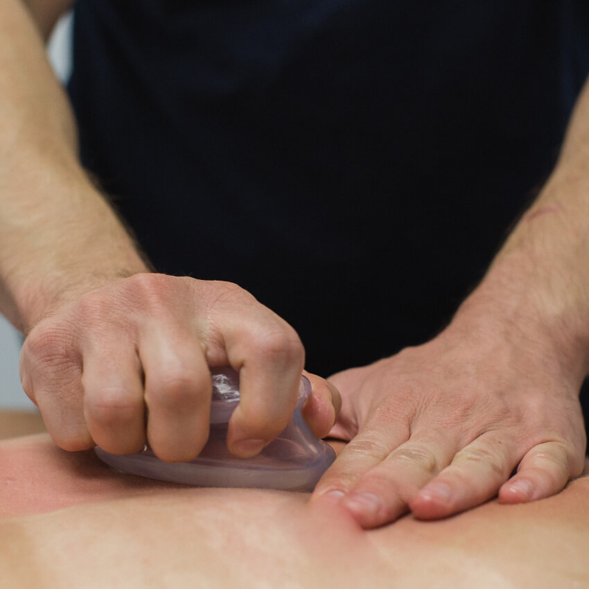 cupping tool on patients skin