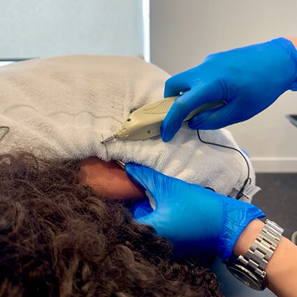 garrett-performing-dry-needling