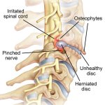 Spine Diagram