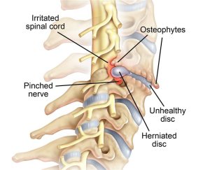 Spine Diagram
