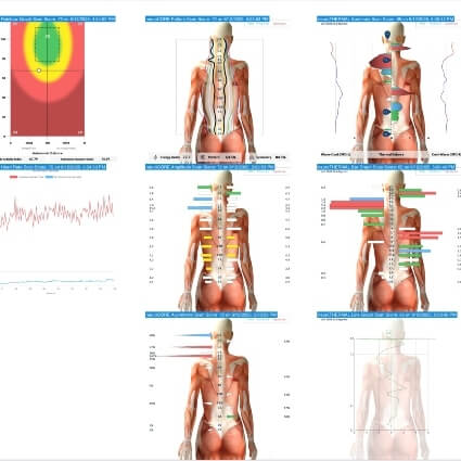 scan images