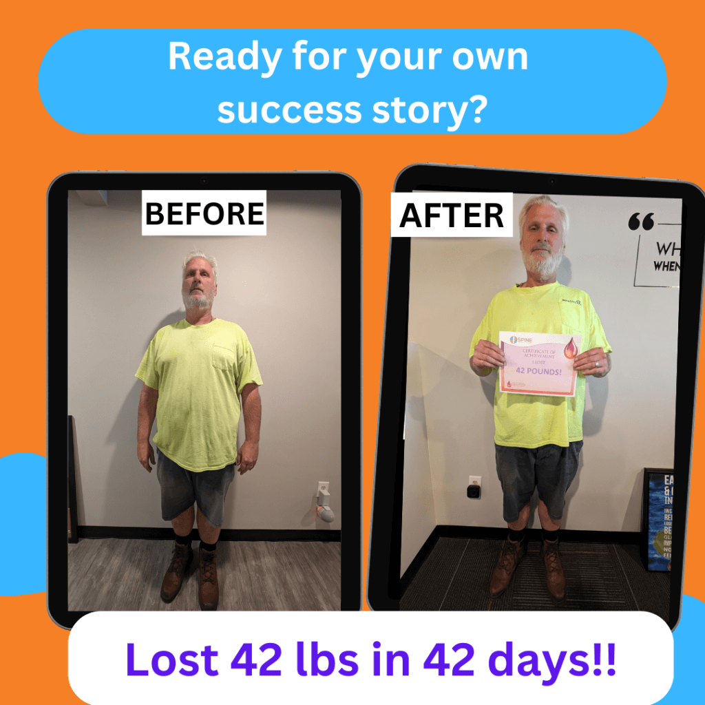 Before and After Photo - Weight Loss of 42  lbs in 42 days
