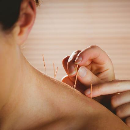Acupuncture used on patient's back