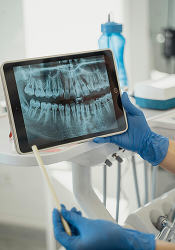 Xray-350X500