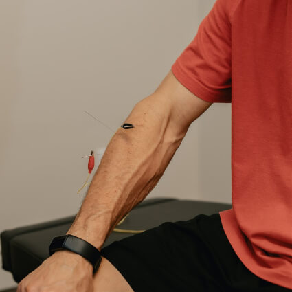 needles in arm