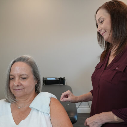 Acupuncture on arm