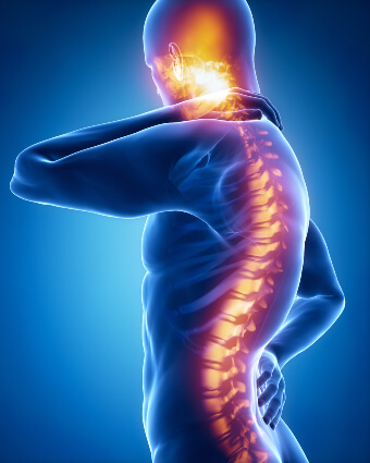 Illustration of spine