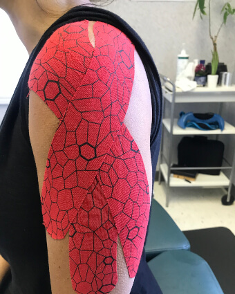 Kinesio Taping on shoulder