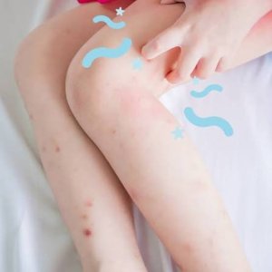 itch