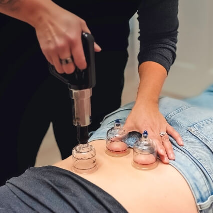 cupping tools on patients back