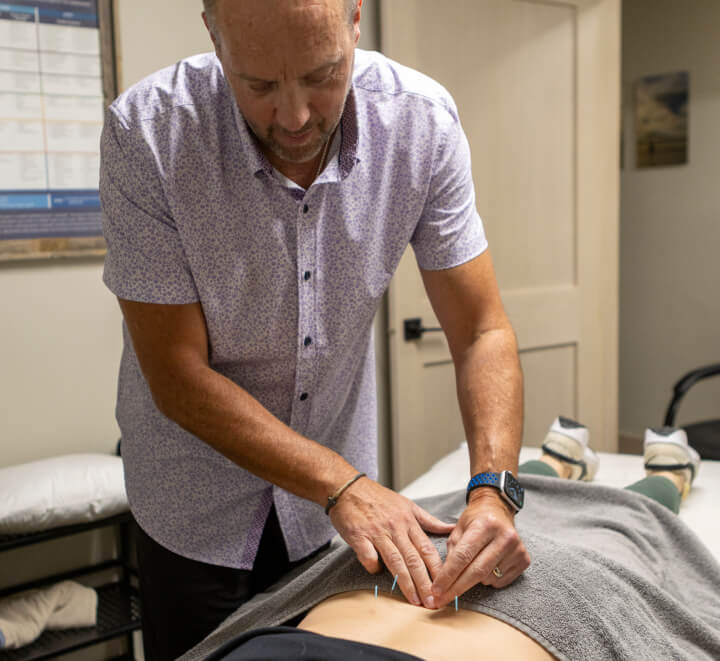 Sturgis chiropractor Dr Goebel putting acupuncture needles in patients back