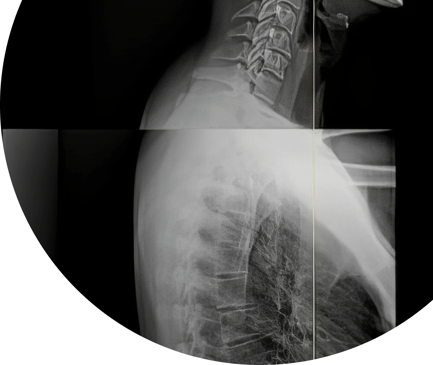 x-rays of persons back