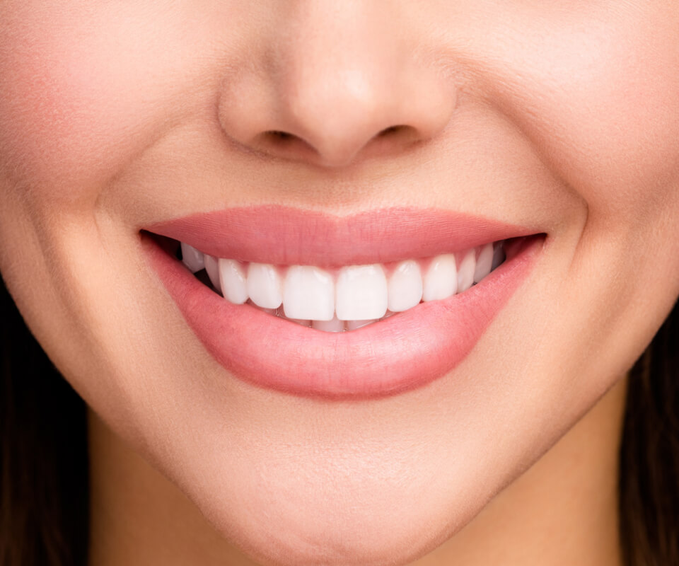 Woman with a beautiful smile