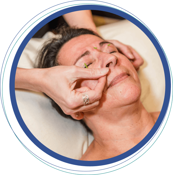 Muskego patient treated with cosmetic acupuncture