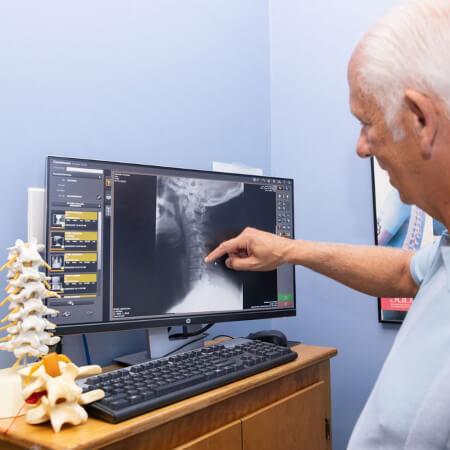 Chiropractor pointing at x-ray