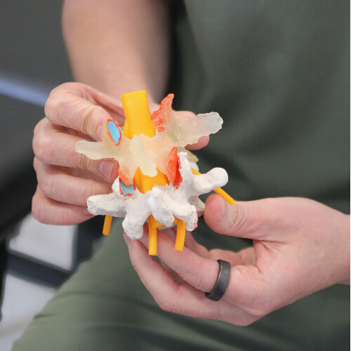Chiropractor holding spine model
