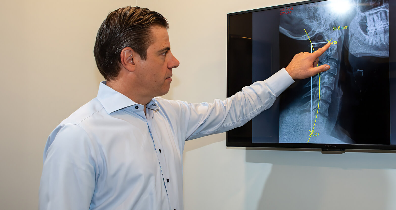 Alexandria Chiropractor Dr. Brian Bodnar pointing to xray