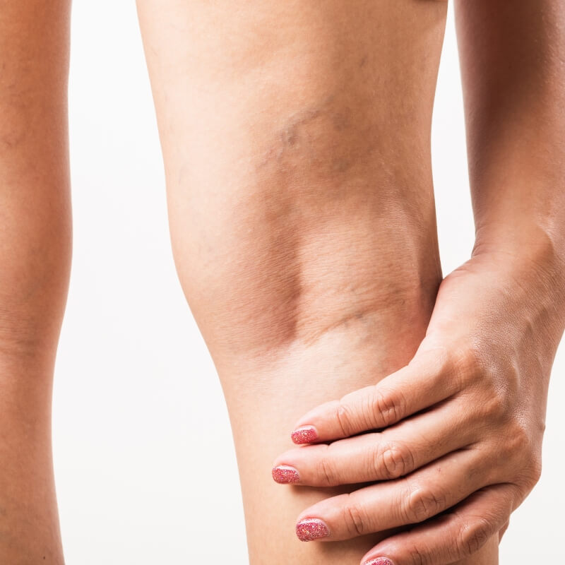 closeup of a woman's legs