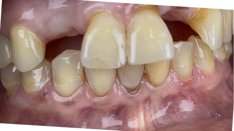 Before treatment