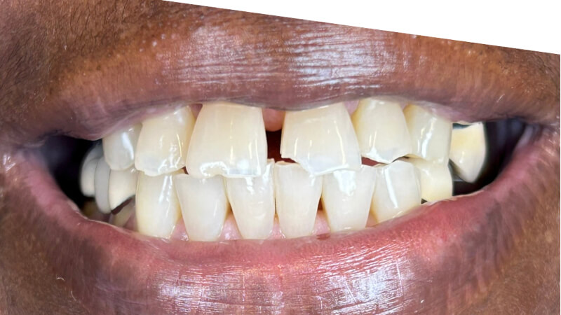 Before treatment