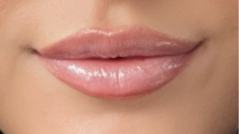 After treatment