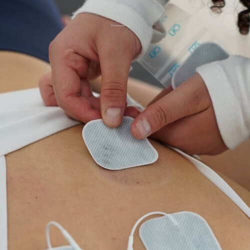 Patient treated with E-Stim Therapy