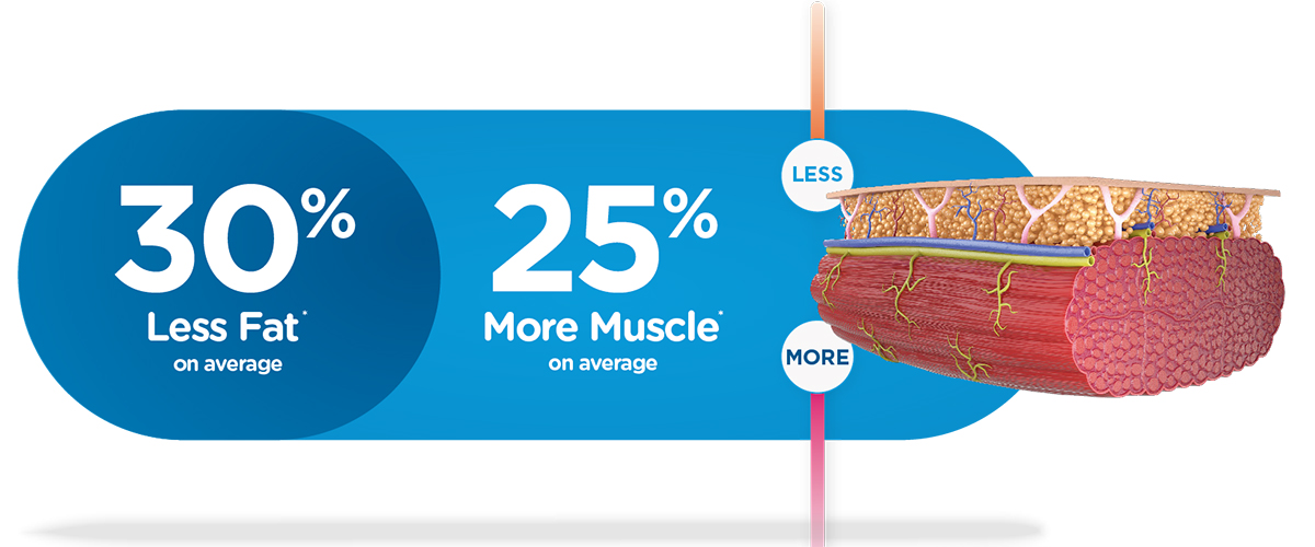 Emsculpt_Neo_PIC_Less-fat-more-muscle-illustration_ENUS100