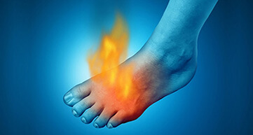 illustration foot with flames